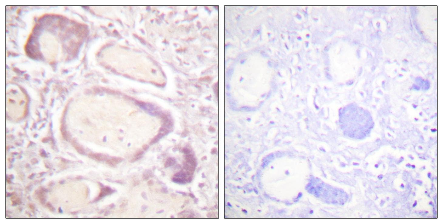 CCNB1 / Cyclin B1 Antibody (phospho-Ser147)