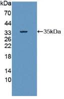 RIPK1 / RIP Antibody (aa17-289)
