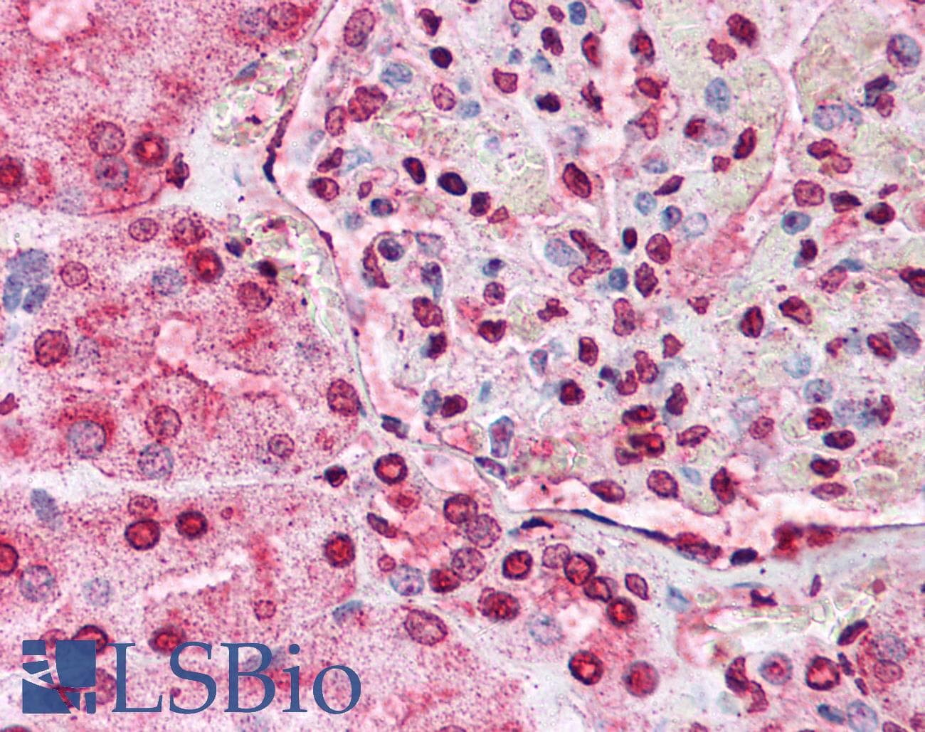 IHC-plus™ NBN / Nibrin Antibody (clone 1D7)