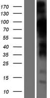 STIM2 Protein (Over-Expression Lysate Myc-DDK (Flag))