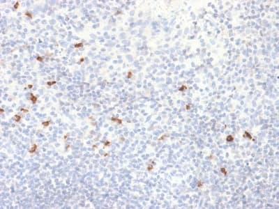 Recombinant Monoclonal Rabbit anti-Human IGHG4 Antibody (clone IGHG4/2042R, Azide-free,Carrier-free, IHC)