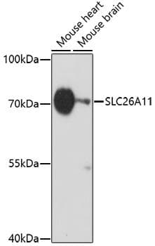 Polyclonal Rabbit anti-Human SLC26A11 Antibody (WB)