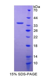 Human GATA2 Protein (Recombinant His-T7)