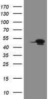 Monoclonal Mouse anti-Human GORAB / SCYL1BP1 Antibody (clone OTI1E3, aa35-394, IHC, WB)