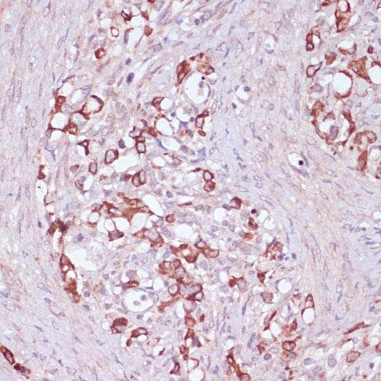 Polyclonal Rabbit anti-Human UGT2B15 Antibody (IHC)