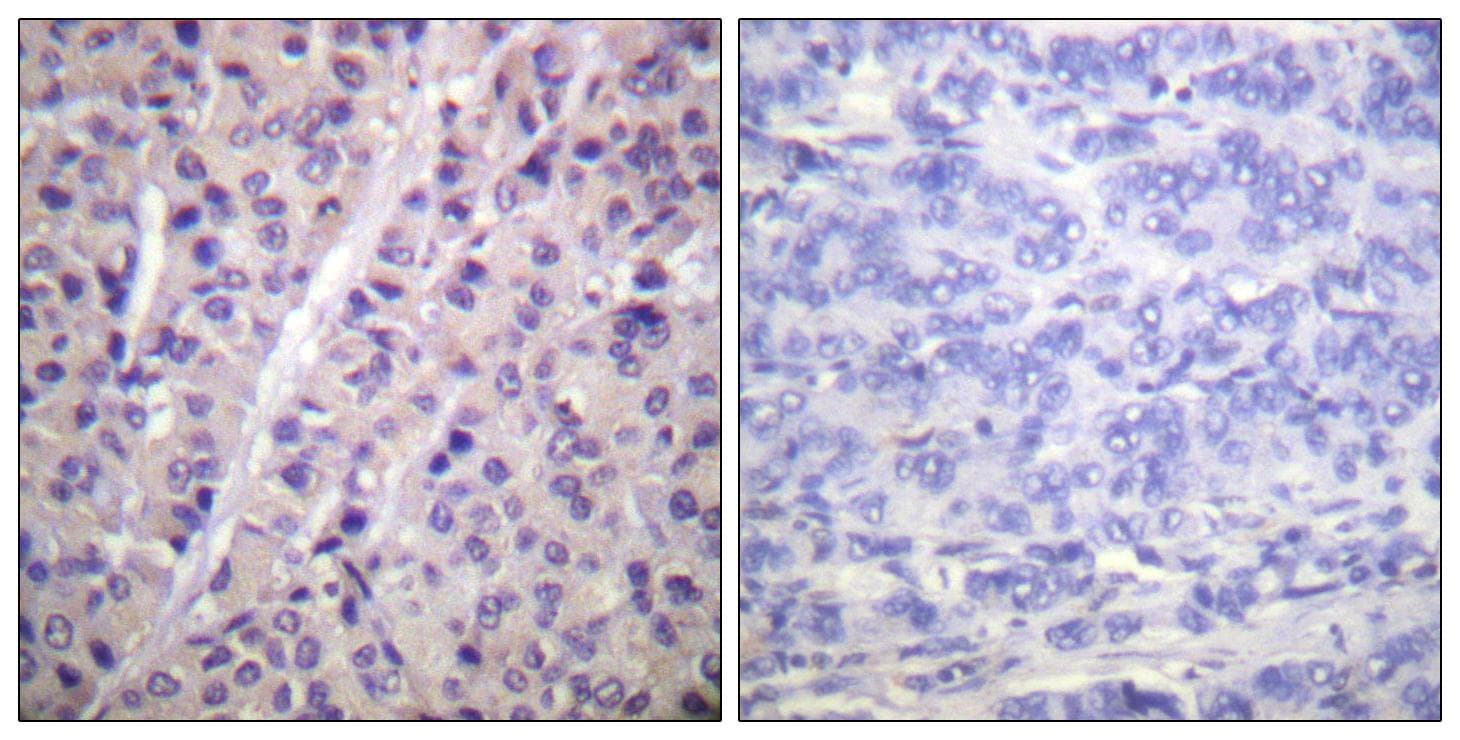 ARAF / ARAF1 / A-RAF Antibody (phospho-Tyr302)