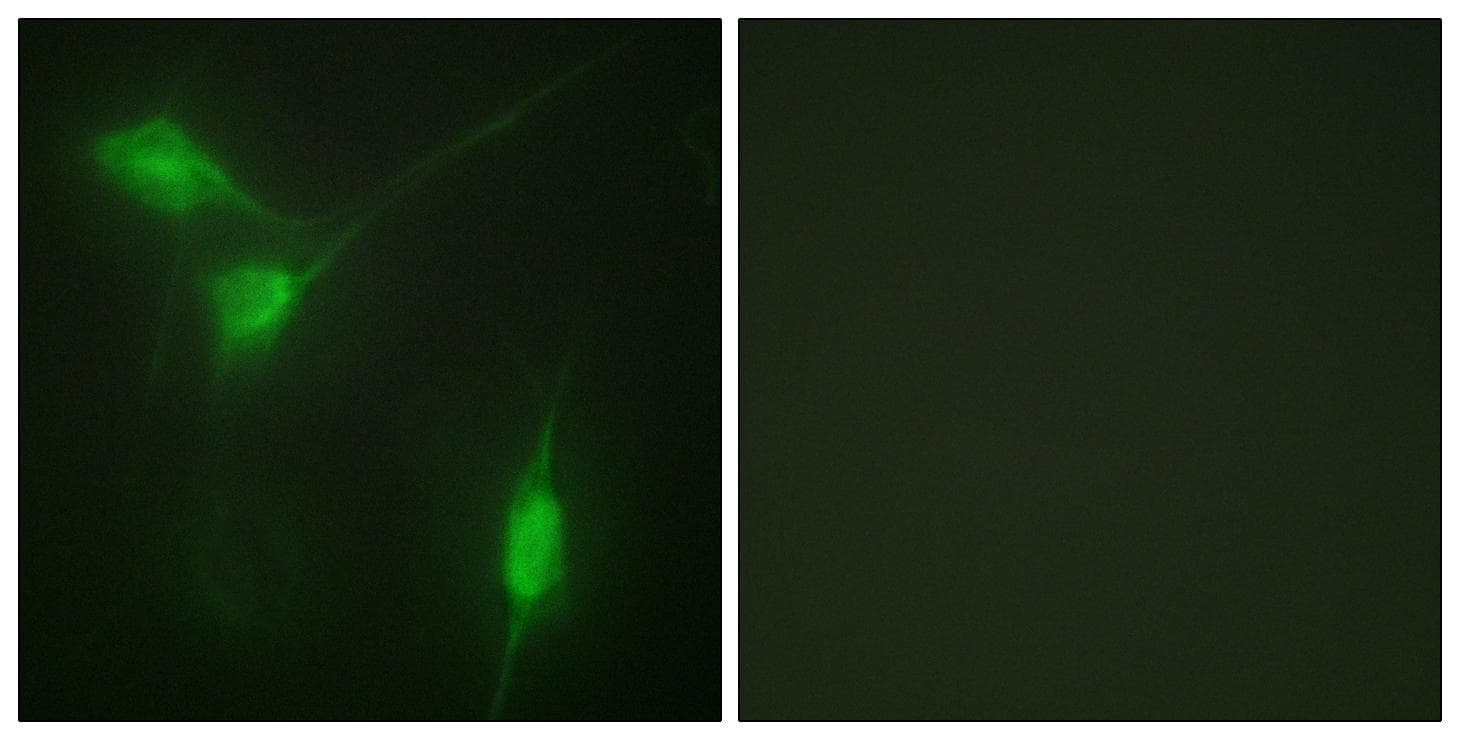 Polyclonal Rabbit anti-Human AKT1 Antibody (phospho-Ser246, IHC, IF, WB)