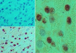 MNX1 / HB9 Antibody (aa330-380)