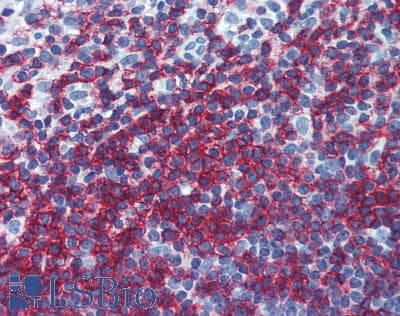 IHC-plus™ CD45RB Antibody (clone MEM-55)