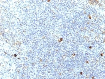 HLA-A25 + HLA-Aw32 Antibody (clone SPM417, Azide-free, BSA-free)