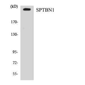 Polyclonal Rabbit anti-Human SPTBN1 / ELF Antibody (aa638-687, WB)