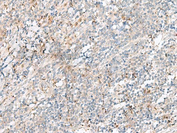 Polyclonal Rabbit anti-Human PLCL2 Antibody (IHC)