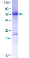 Human SMTNL2 Protein (Recombinant GST)