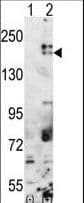 ESET / SETDB1 Antibody (aa1193-1225)
