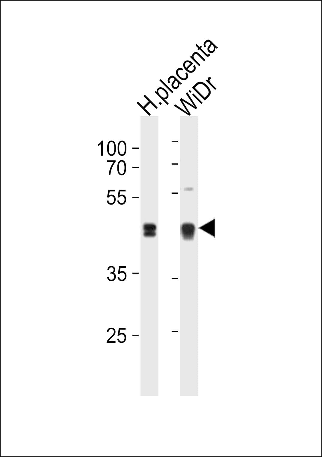 Polyclonal Rabbit anti-Human SAP30BP / HTRG Antibody (aa160-188, WB)