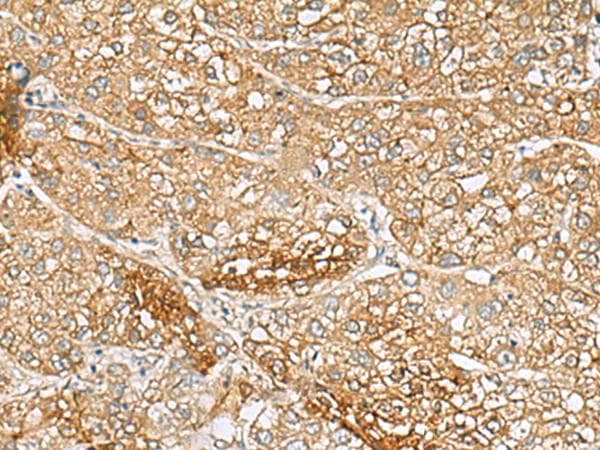 C1orf112 Antibody