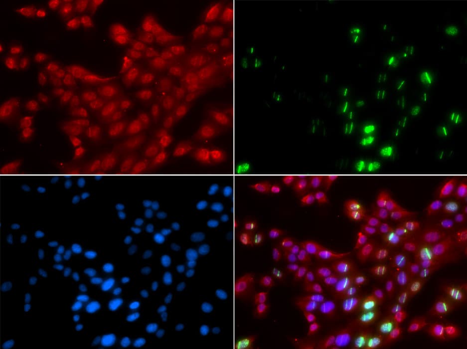 Polyclonal Rabbit anti-Human TP53BP1 / 53BP1 Antibody (IHC, IF, WB)