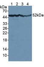 ENO2 / NSE Antibody (aa2-434)