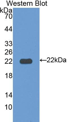 ITLN1 / Omentin Antibody (aa101-292)