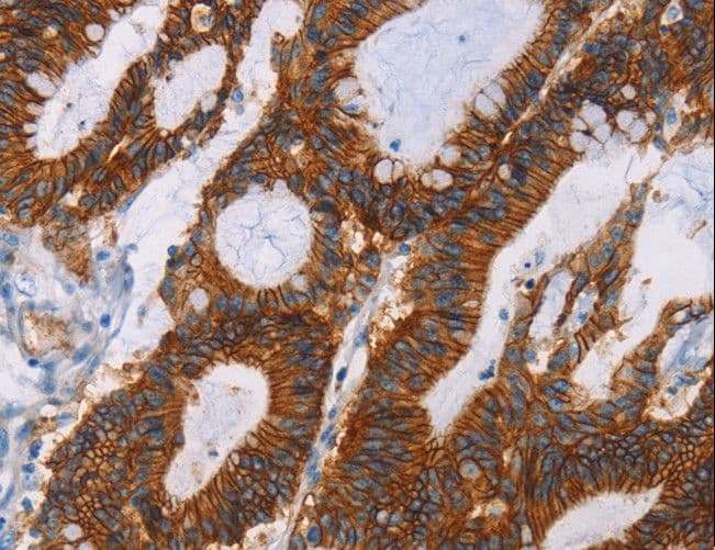 GPA33 / A33 Antibody