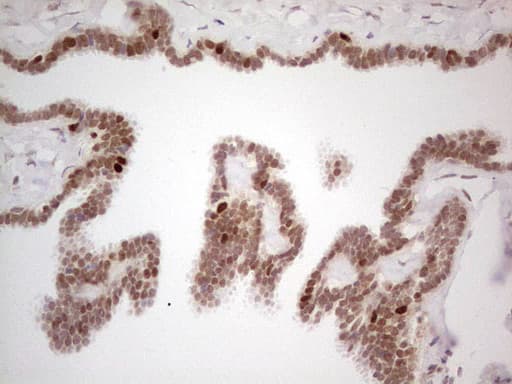 RB1 / Retinoblastoma / RB Antibody (aa309-590, clone OTI10H9)