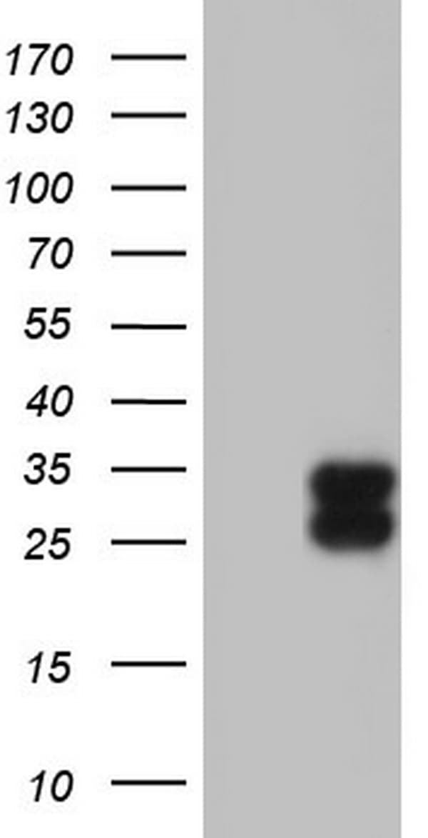 Monoclonal Mouse anti-Human TFPI2 Antibody (clone OTI1D4, aa23-235, IHC, WB)