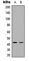 FRA-1 / FOSL1 Antibody (Internal)
