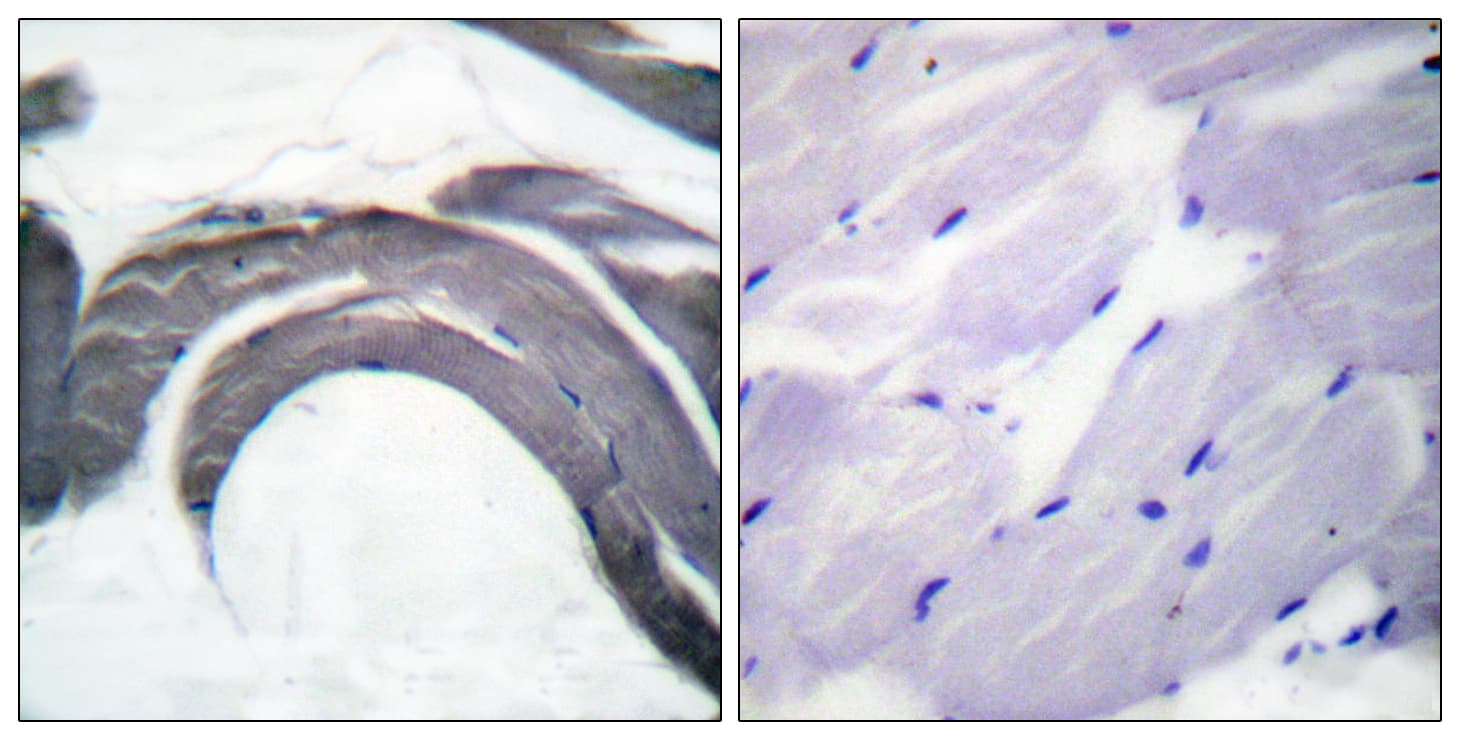 GYS1 / Glycogen Synthase Antibody (phospho-Ser645)