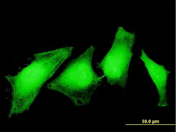 ASPA Antibody (clone 3C11)