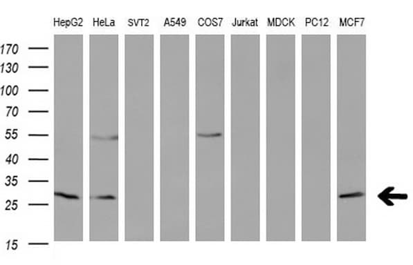 BCL2 / Bcl-2 Antibody (clone OTI10C7)