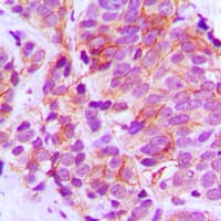STEAP4 Antibody (Internal)