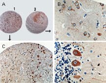 Polyclonal Rabbit anti-Human CASP8 / Caspase 8 Antibody (IHC, WB)