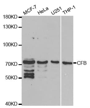 Polyclonal Rabbit anti-Human CFB / Complement Factor B Antibody (IHC, WB)