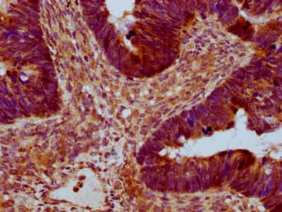 Polyclonal Rabbit anti-Human RAB21 Antibody (IHC, IF)