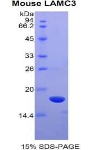 Mouse LAMC3 / Laminin Gamma 3 Protein (Recombinant His)