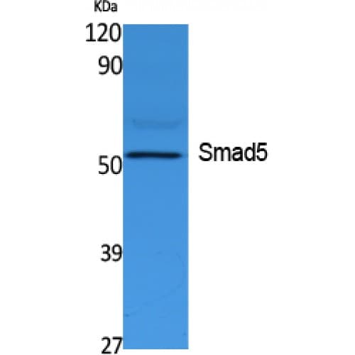 SMAD5 Antibody (Internal)