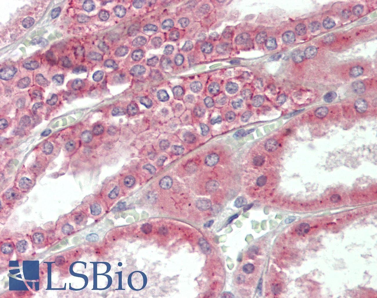 IHC-plus™ SUCNR1 / GPR91 Antibody (70-150 aa, Internal)