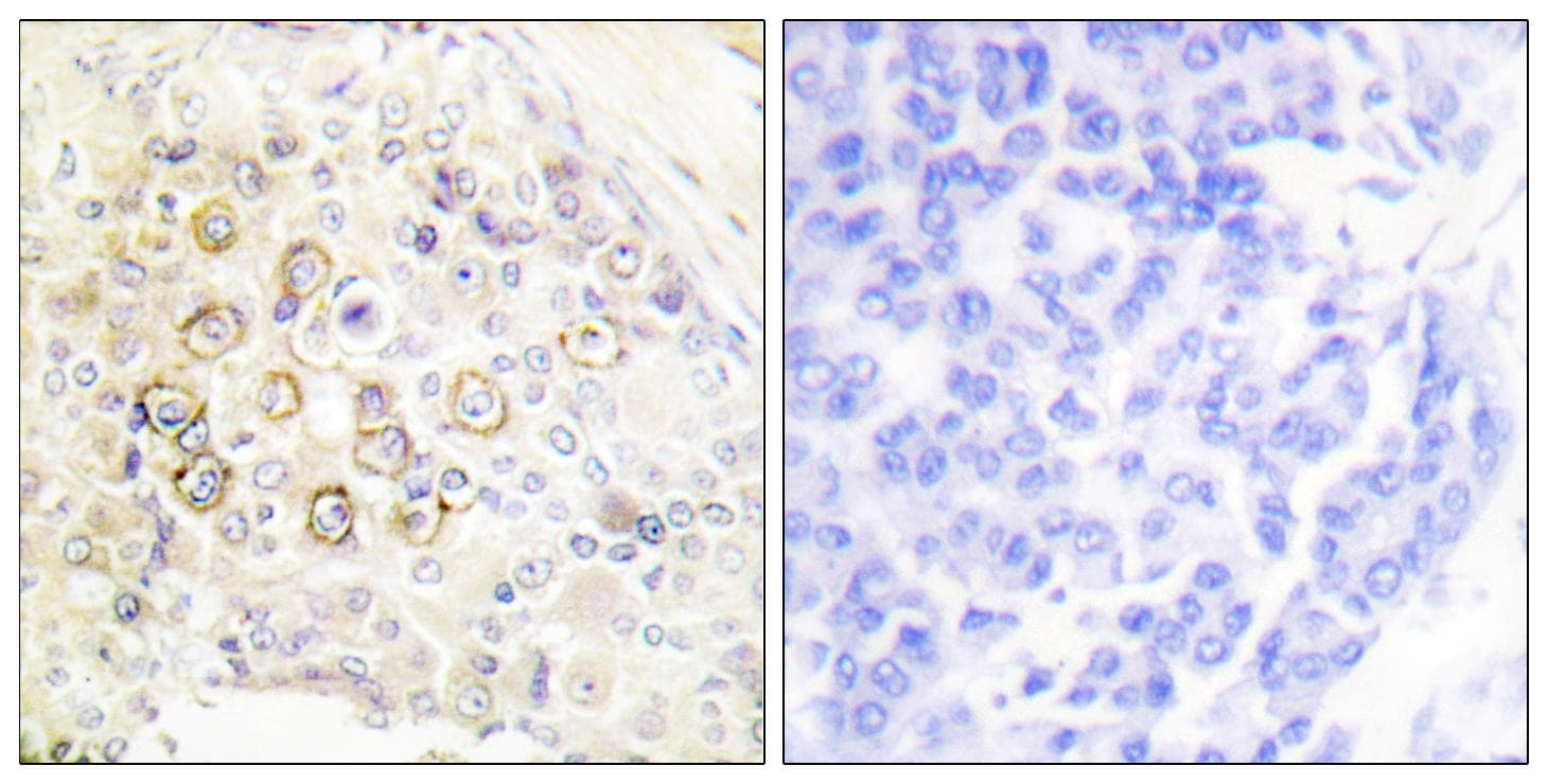 Polyclonal Rabbit anti-Human ERBB3 / HER3 Antibody (IHC, WB)