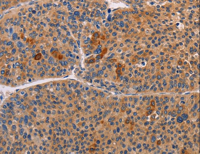 ALDH3A1 Antibody