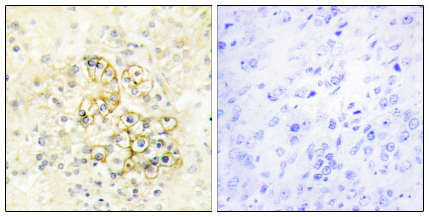 TMEPAI / PMEPA1 Antibody