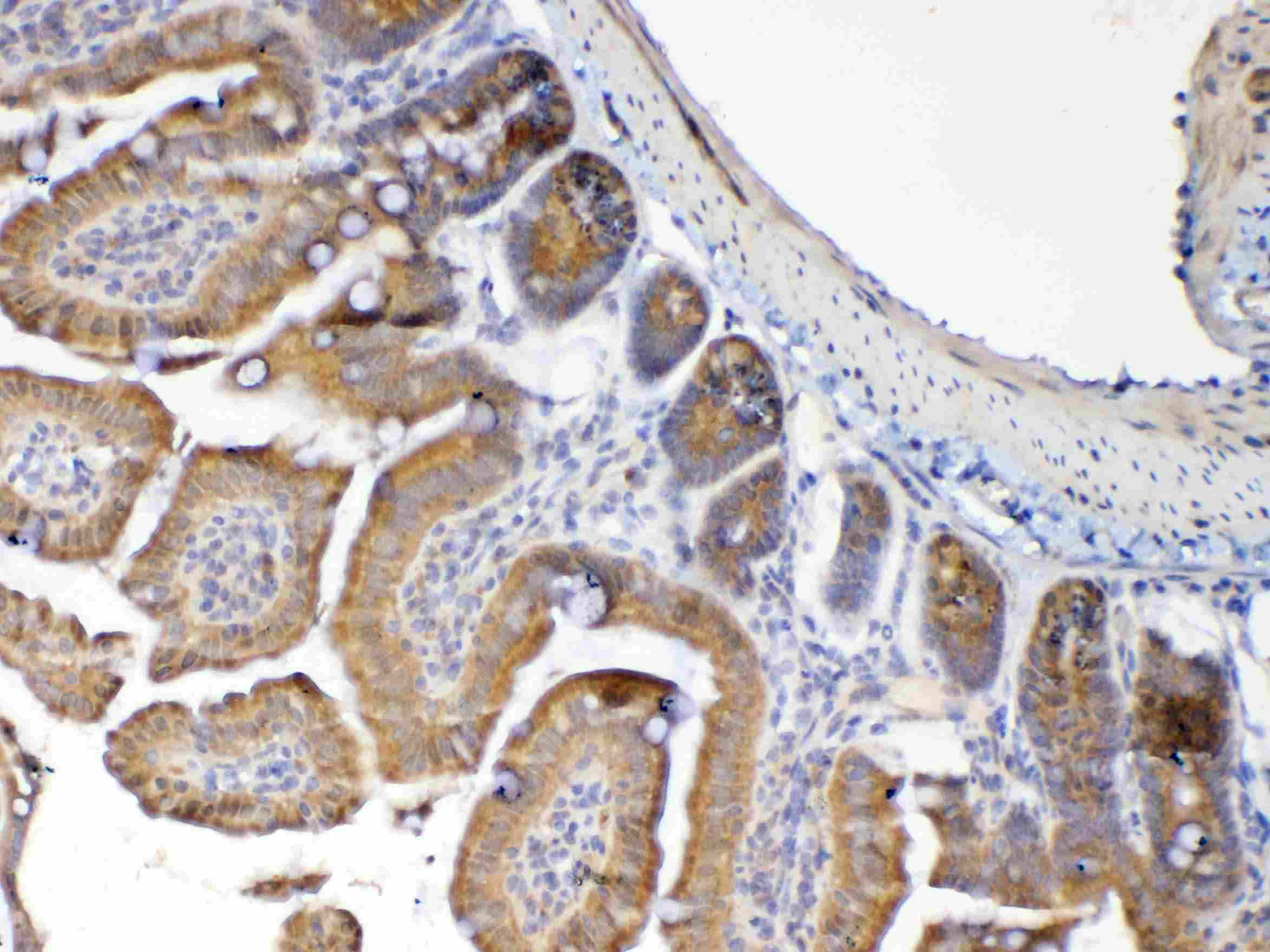 Polyclonal Rabbit anti-Human EMA / MUC1 Antibody (IHC, WB)