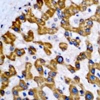 NDUFA2 Antibody