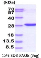 Human MYL4 Protein (Recombinant His)