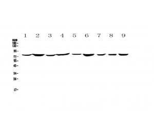 Polyclonal Rabbit anti-Human ANXA6/Annexin A6/Annexin VI Antibody (IHC, WB)
