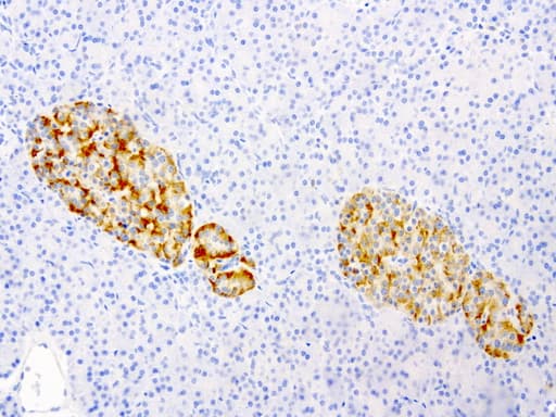 VILIP / VSNL1 Antibody (aa2-191, clone UMAB115, Carrier-free)