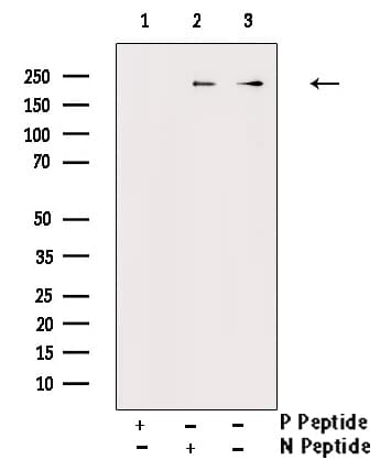 Polyclonal Rabbit anti-Human MTOR Antibody (phospho-Thr2446, WB)