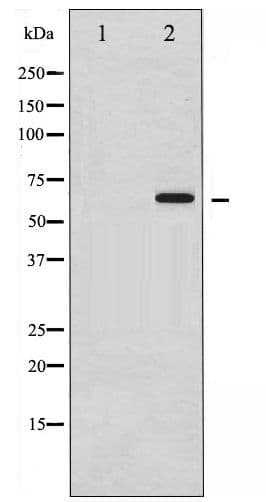 SMAD1 Antibody (phospho-Ser465)