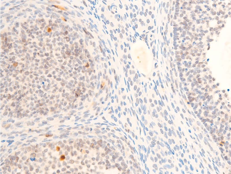 MYC / c-Myc Antibody (phospho-Thr58)