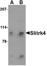 IHC-plus™ SLITRK4 Antibody