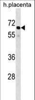 GRHL3 Antibody (aa1-30)